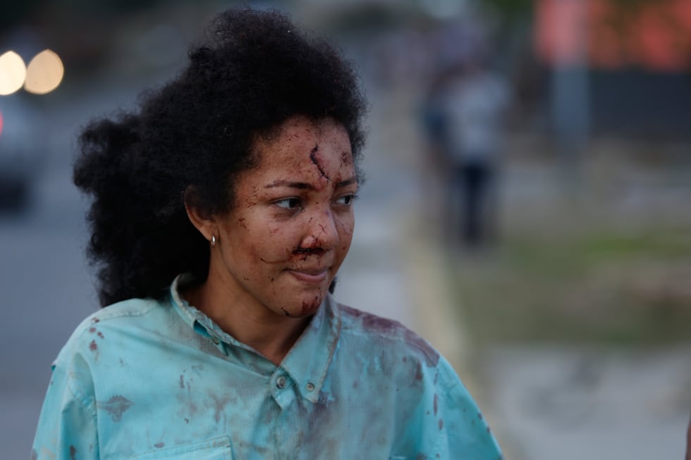 Una mujer herida camina por La Guaira, Venezuela, un día después de que un terremoto sacudiera...